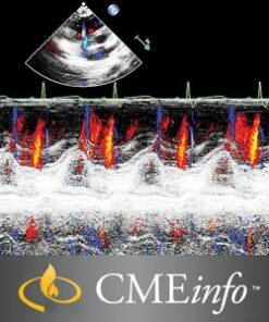 Echocardiography – A Comprehensive Review 2020