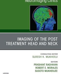 Imaging of the Post Treatment Head and Neck, An Issue of Neuroimaging Clinics of North America, E-Book (Clinics Collections) (Original PDF from Publisher)