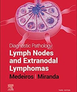 Diagnostic Pathology: Lymph Nodes and Extranodal Lymphomas, 3rd Edition (Original PDF from Publisher)