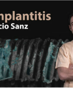 Peri-Implantitis: Prevention and Treatment (Video Course)