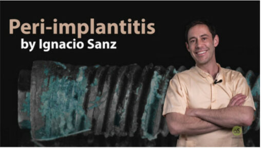 Peri-Implantitis: Prevention and Treatment (Video Course)