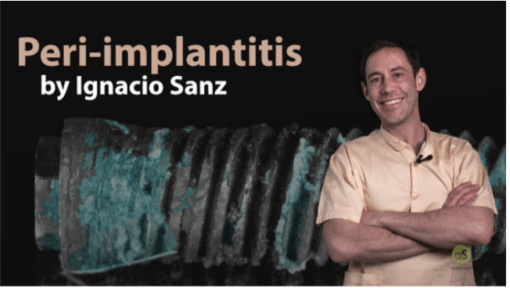 Peri-Implantitis: Prevention and Treatment (Video Course)