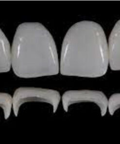 Prosthetic Rehabilitation on Natural Teeth: Predictable, Esthetic and Systematic Steps