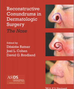 Reconstructive Conundrums in Dermatologic Surgery: The Nose 1st Edition
