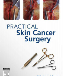 Practical Skin Cancer Surgery