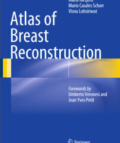 Atlas of Breast Reconstruction 2015th Edition