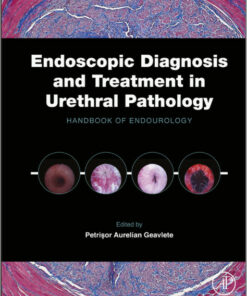 Endoscopic Diagnosis and Treatment in Urethral Pathology: Handbook of Endourology