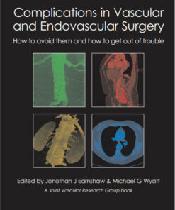 Complications in Vascular and Endovascular Surgery: How to Avoid Them and How to Get Out of Trouble 1st Edition