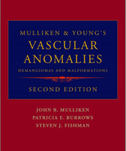 Mulliken and Young's Vascular Anomalies: Hemangiomas and Malformations