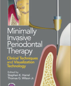 Ebook  Minimally Invasive Periodontal Therapy: Clinical Techniques and Visualization Technology 1st Edition
