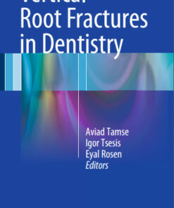 Ebook  Vertical Root Fractures in Dentistry 2015th Edition