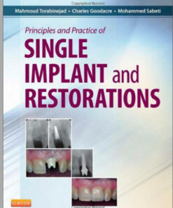 Ebook Principles and Practice of Single Implant and Restoration, 1e 1st Edition