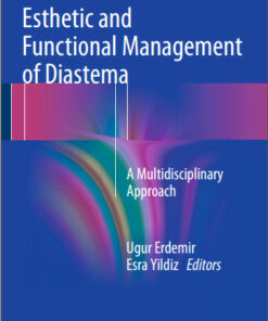 Ebook Esthetic and Functional Management of Diastema: A Multidisciplinary Approach 1st ed. 2016 Edition