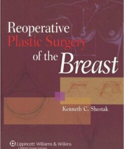 Reoperative Plastic Surgery of the Breast 1st Edition