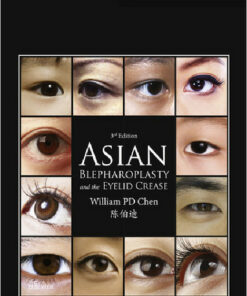 Asian Blepharoplasty and the Eyelid Crease, 3e 3rd Edition