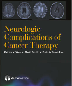 Neurologic Complications of Cancer Therapy 1st Edition
