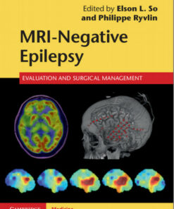 MRI-Negative Epilepsy: Evaluation and Surgical Management 1st Edition