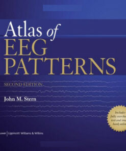 Atlas of EEG Patterns Second Edition