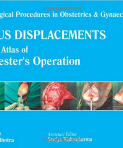 Uterus Displacements: A Colour Atlas of Manchester's Operation 1st Edition