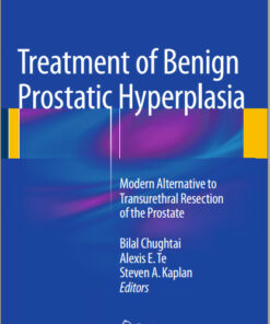 Treatment of Benign Prostatic Hyperplasia: Modern Alternative to Transurethral Resection of the Prostate 2015th Edition