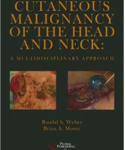 Cutaneous Malignancy of the Head and Neck: A Multidisciplinary Approach 1st Edition
