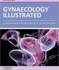 Gynaecology Illustrated, 6e 6th Edition