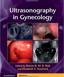 Ultrasonography in Gynecology 1st Edition