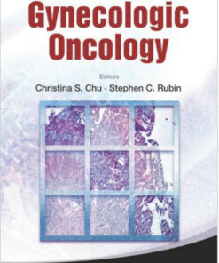 Manual of Gynecologic Oncology 1st Edition