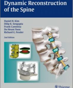 Dynamic Reconstruction of the Spine 1E