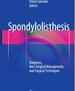 Spondylolisthesis: Diagnosis, Non-Surgical Management, and Surgical Techniques 2015th Edition