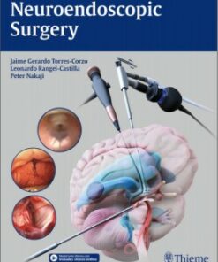 Neuroendoscopic Surgery 1st Edition