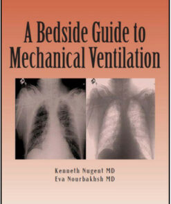 A Bedside Guide To Mechanical Ventilation