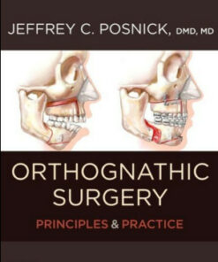 Orthognathic Surgery: Principles and Practice – 2 Volume Set