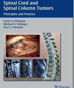 Spinal Cord and Spinal Column Tumors: Principles and Practice