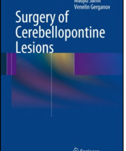 Surgery of Cerebellopontine Lesions