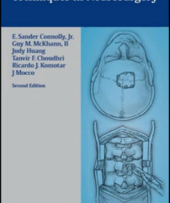 Fundamentals of Operative Techniques in Neurosurgery, 2nd Edition
