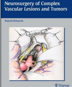 Neurosurgery of Complex Vascular Lesions and Tumors