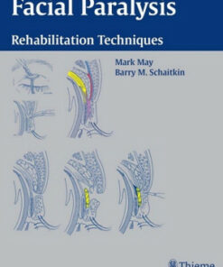 Facial Paralysis: Rehabilitation Techniques