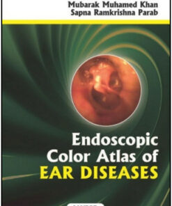 Endoscopic Color Atlas of Ear Diseases