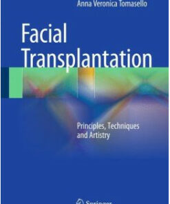Face Transplantation: Principles, Techniques and Artistry