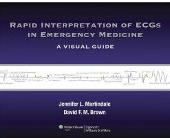 Rapid Interpretation of ECGs in Emergency Medicine: A Visual Guide