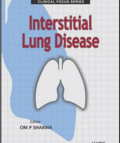 Clinical Focus Series: Interstitial Lung Disease
