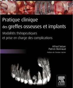 Pratique clinique des greffes osseuses et implants: Modalités thérapeutiques et prise en charge des complications (French Edition)