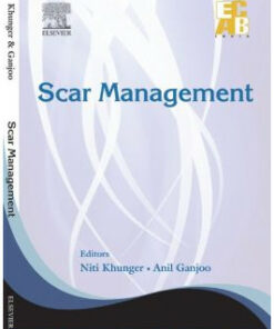 Scar Management – ECAB