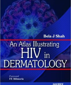 An Atlas Illustrating HIV in Dermatology