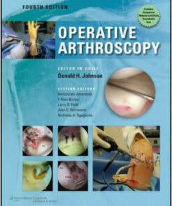 Operative Arthroscopy, 4th Edition