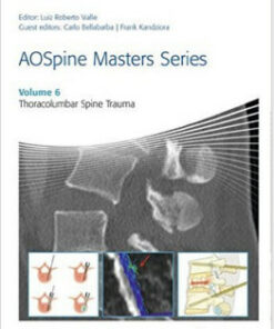 AOSpine Masters Series, Volume 6: Thoracolumbar Spine Trauma 1st Edition