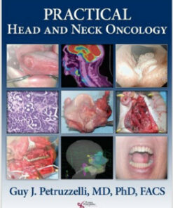 Practical Head and Neck Oncology