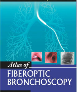 Atlas of Fiberoptic Bronchoscopy 1st Edition