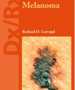 Dx/Rx: Melanoma